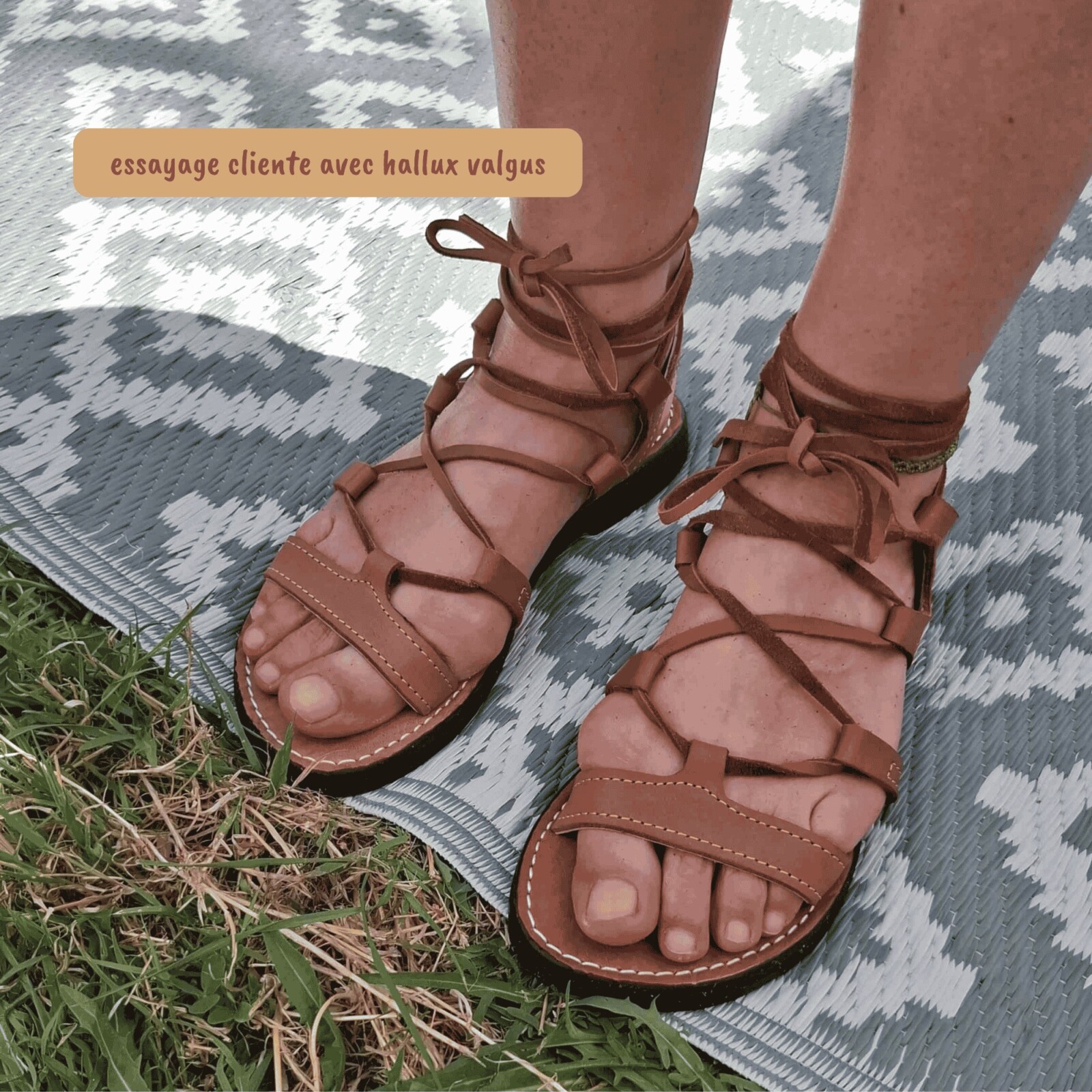 Essai sandales gazelles aux pieds avec hallux valgus